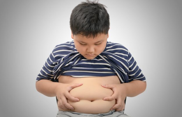 santa-casa-obesidade-infantil Obesidade Infantil